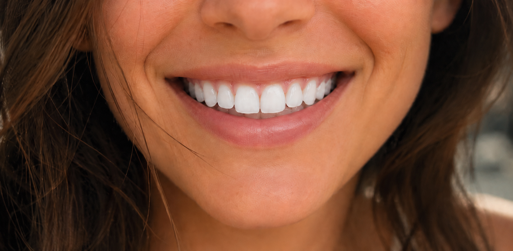 A confident, natural looking smile after gentle cosmetic treatment